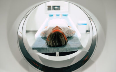 Ressonância Magnética com Inteligência Artificial em Jacobina e Região